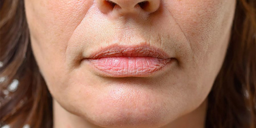 چه زمانی افتادگی پوست طبیعی نیست؟