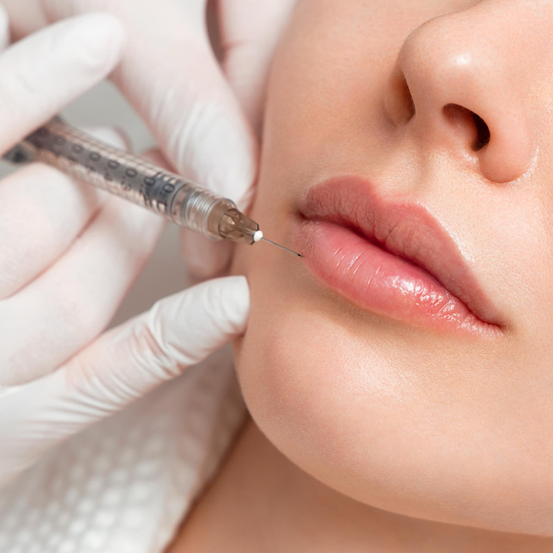 ورم بعد از تزریق فیلر؛ چه زمانی طبیعی است و چه زمانی زنگ خطر؟